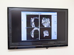 CT撮影、診断料